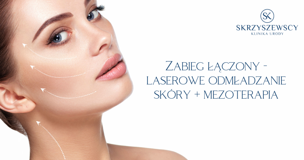 laserowe odmładzanie skóry i mezoterapia, Laserowe odmładzanie skóry i mezoterapia &#8211; zabieg łączony